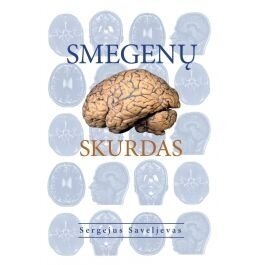 Smegenų skurdas